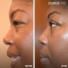 Judge MD: Judge MD