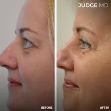 Judge MD: Judge MD