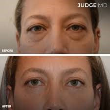 Judge MD: Judge MD